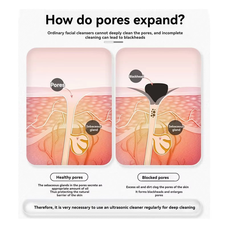 【Fuxq】Skin Spatula Beauty Device Face Cleanser, Blackhead Remover, Deep Cleansing Facial Face Scrubber