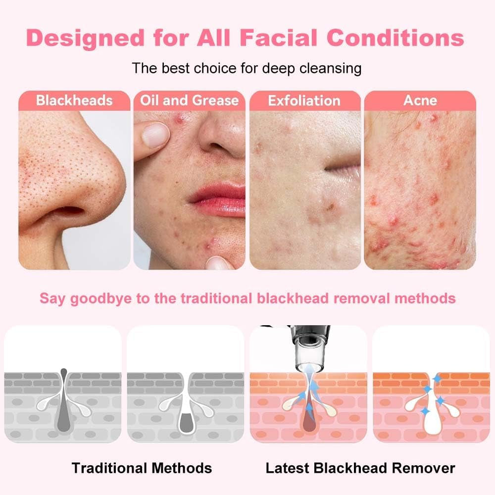 Blackhead Remover Pore Vacuum,Facial Pore Cleaner-5 Suction Power,5 Probes,Usb Rechargeable Blackhead Vacuum Kit for Adult