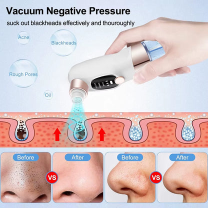 Electric Blackhead Remover Pore Vacuum Cleaner Facial Black Dots Vacuum Cleaner Pimple Acne Blackhead Removal Black Dots Remover