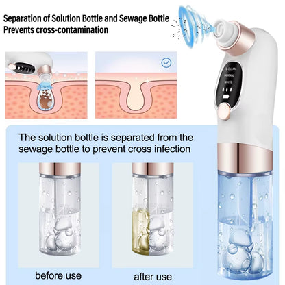 Electric Blackhead Remover Pore Vacuum Cleaner Facial Black Dots Vacuum Cleaner Pimple Acne Blackhead Removal Black Dots Remover