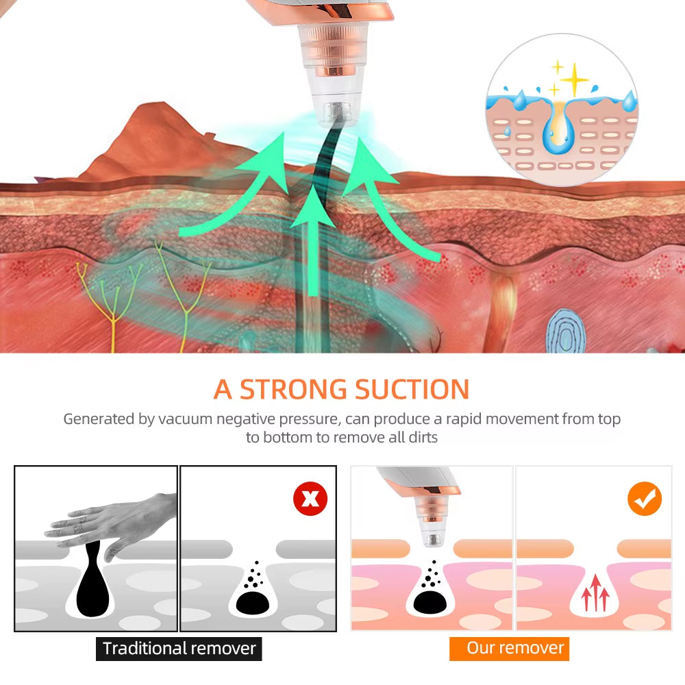 Nose Blackhead Remover Face Cleansing Beauty Machine Facial Suction Cleaner Pimple Dead Skin Remover Extractor Skin Care Tools