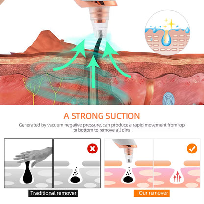 Nose Blackhead Remover Face Cleansing Beauty Machine Facial Suction Cleaner Pimple Dead Skin Remover Extractor Skin Care Tools